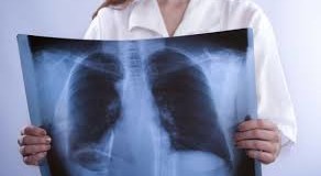 Eurostat: 13 decessi su 100 nella Ue dovuti a malattie respiratorie