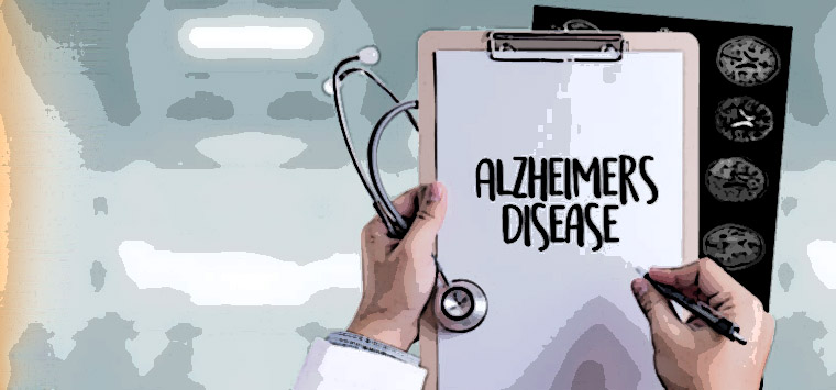 Alzheimer, scoperta del Cnr apre nuove prospettive di cura per rallentare la malattia