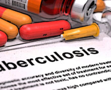 Tbc, warning Ecdc e Oms Europa: “Calo lento, in aumento i casi resistenti ai farmaci”