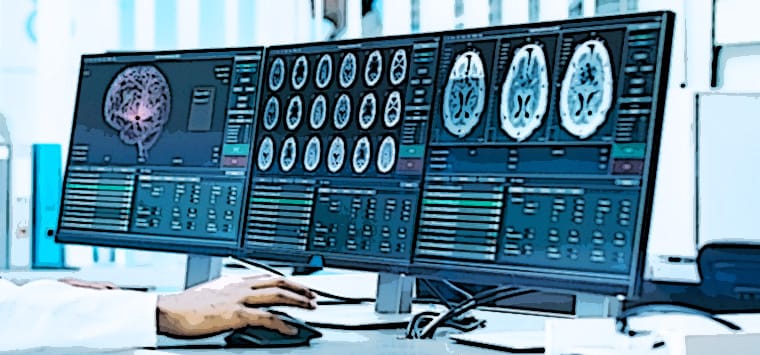 tumori neuroendocrini
