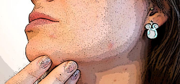 donna viso dermatologia