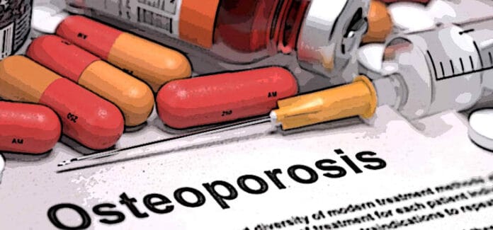 osteoporosis
