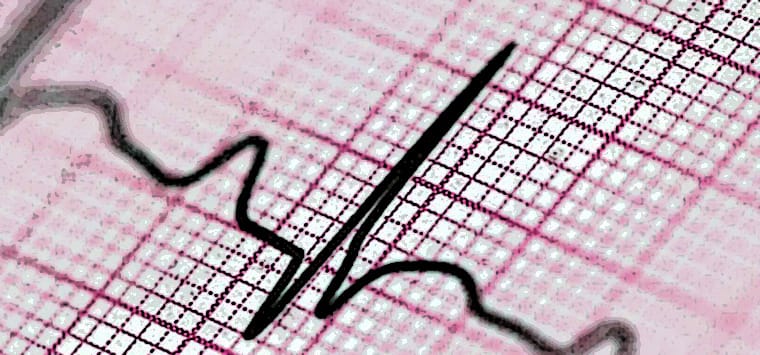 Roma, due diverse farmacie salvano la vita a un uomo e una donna ...